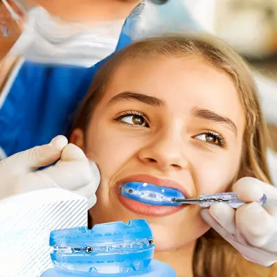Gouttière Anti Ronflement - AntiSnoringMouthGuard™ - Bleu