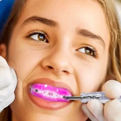 Gouttière Anti Ronflement - AntiSnoringMouthGuard™ - Rose