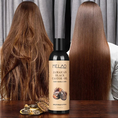 Huile de Ricin - NatureCastorOil™