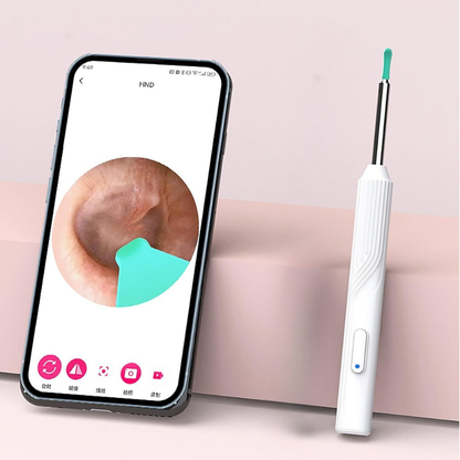 Otoscope Oreille - EarVision™ - Blanc