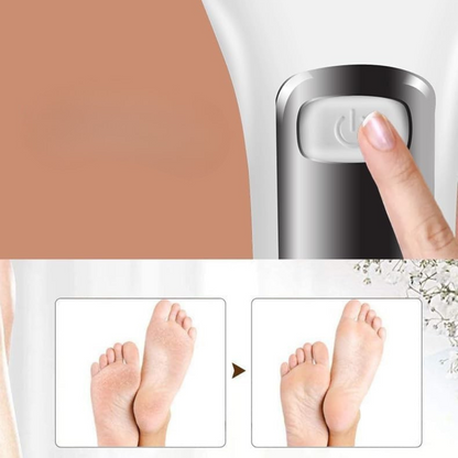 Râpe pour Pieds Électrique - PediPro™ - Blanc Argenté